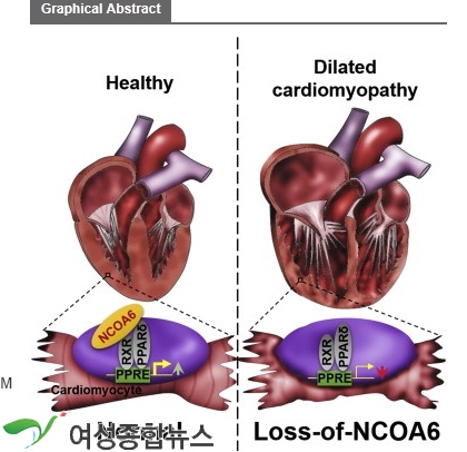 심부전의 새로운 발병 원인 찾아