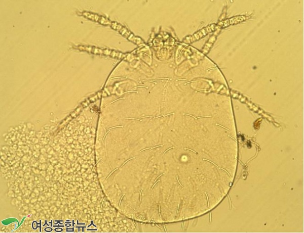 옹진군, 가을철 쯔쯔가무시증 예방 총력